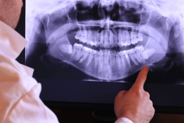 Best Emergency Broken Tooth Repair in George West, TX