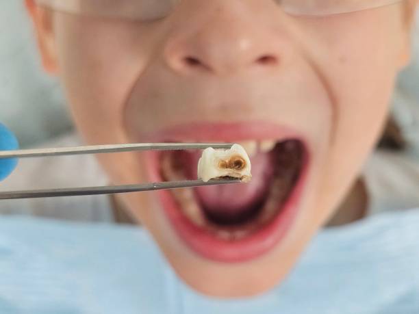 Best Pediatric Emergency Dentist in George West, TX